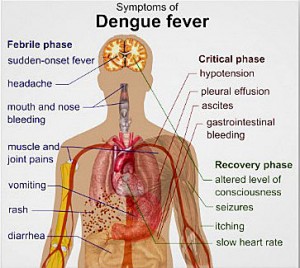 Dengue fever Symptoms