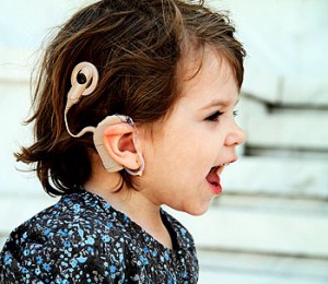 Cochlear Impalnts