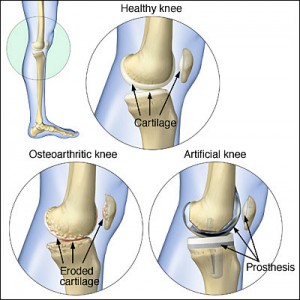 Knee Joint