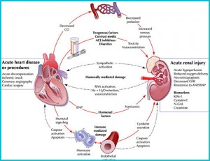 acute-renal-failure