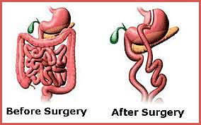 surgery-benefits