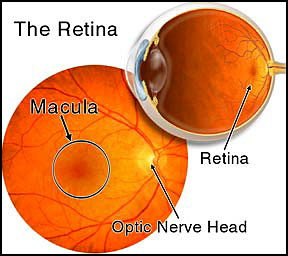 macula-degeneration