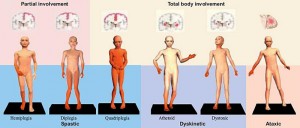 types-of-cerebral-palsy