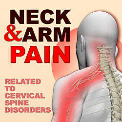 neck-and-arm-pain--related-to-cervical-spine-disorder