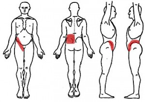 Back Pain and Kidney Infection