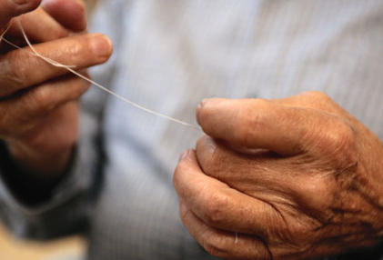 Treating gum disease may help Rheumatoid Arthritis (RA)