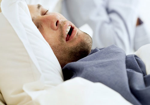 Sleep Apnea Treatment