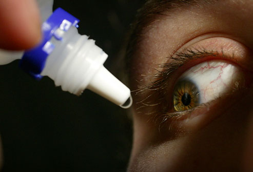 Treating Pinkeye