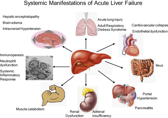 10 Signs & Symptoms of Liver Damage