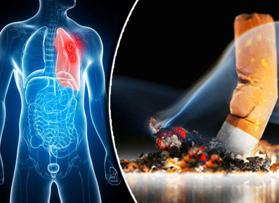 Body-Parts-That-Get-Damaged-by-Smoking