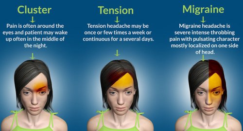How to Get Rid of a Headache Fast