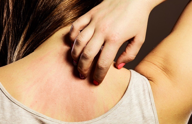 skin allery and treatment