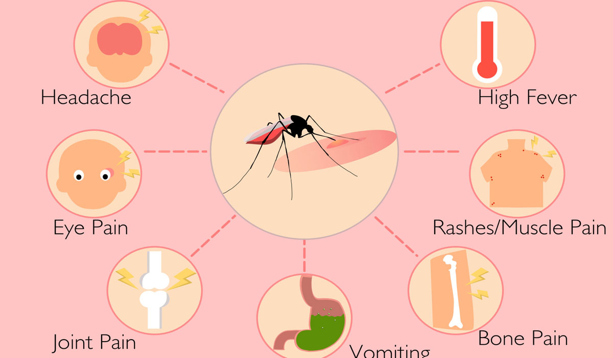 Dengue It’s Causes, Symptoms, Prevention and Treatment Medical