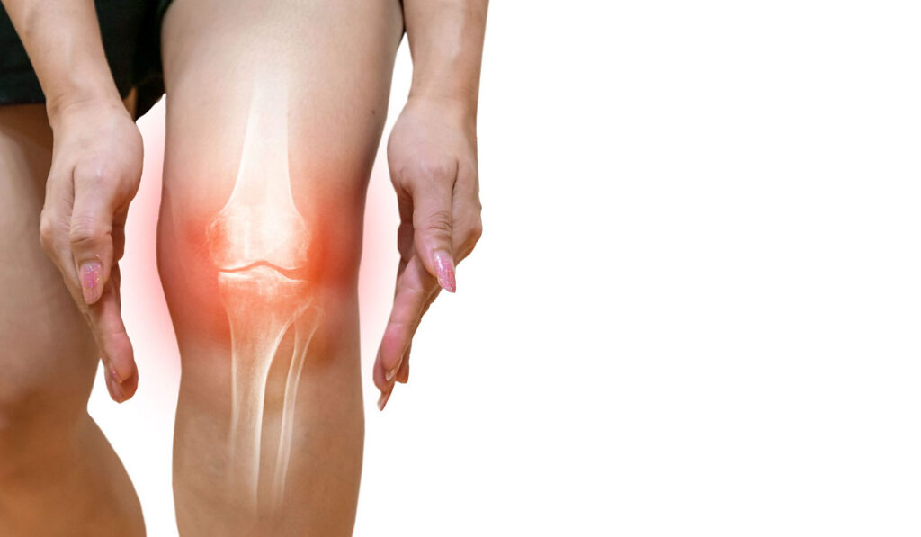 Knee Replacement Last Option to Get rid of Knee Arthritis