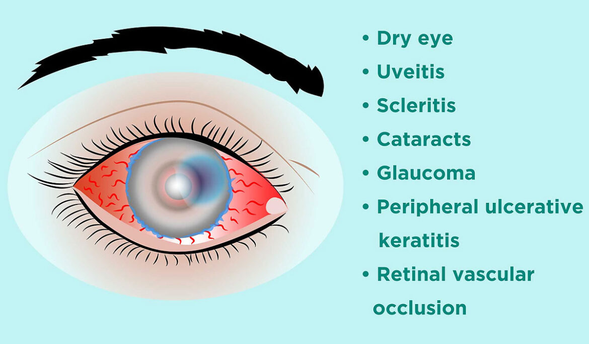 Age-Related Vision Problems-Causes, Symptoms and Treatments Age-Related Vision Problems-Causes, Symptoms and Treatments