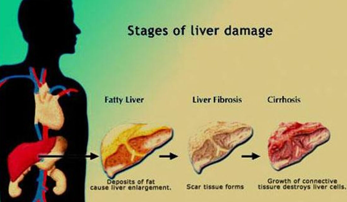 Mediconnect Awareness Mission – World Hepatitis