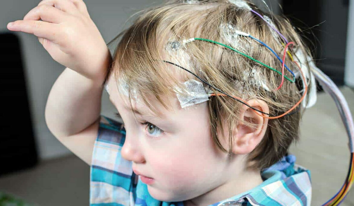 Pediatric Neurology : Cerebral Palsy II