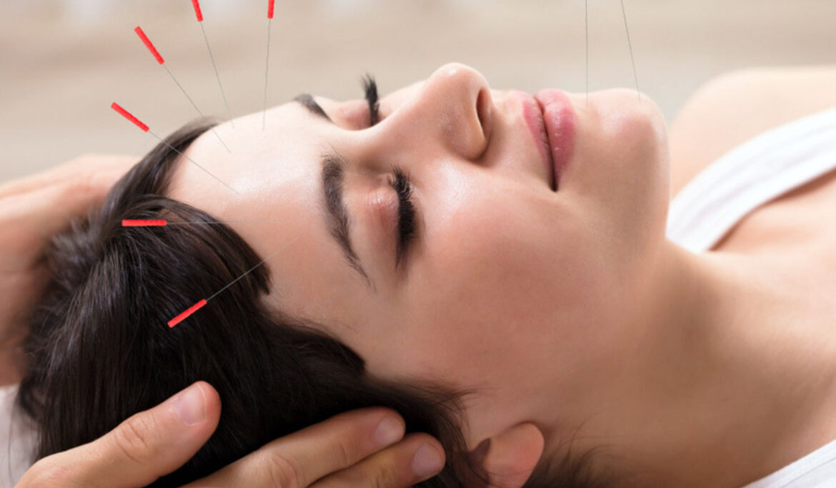 a-guide-to-acupuncture