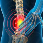 Common Myths and Facts about Back Pain
