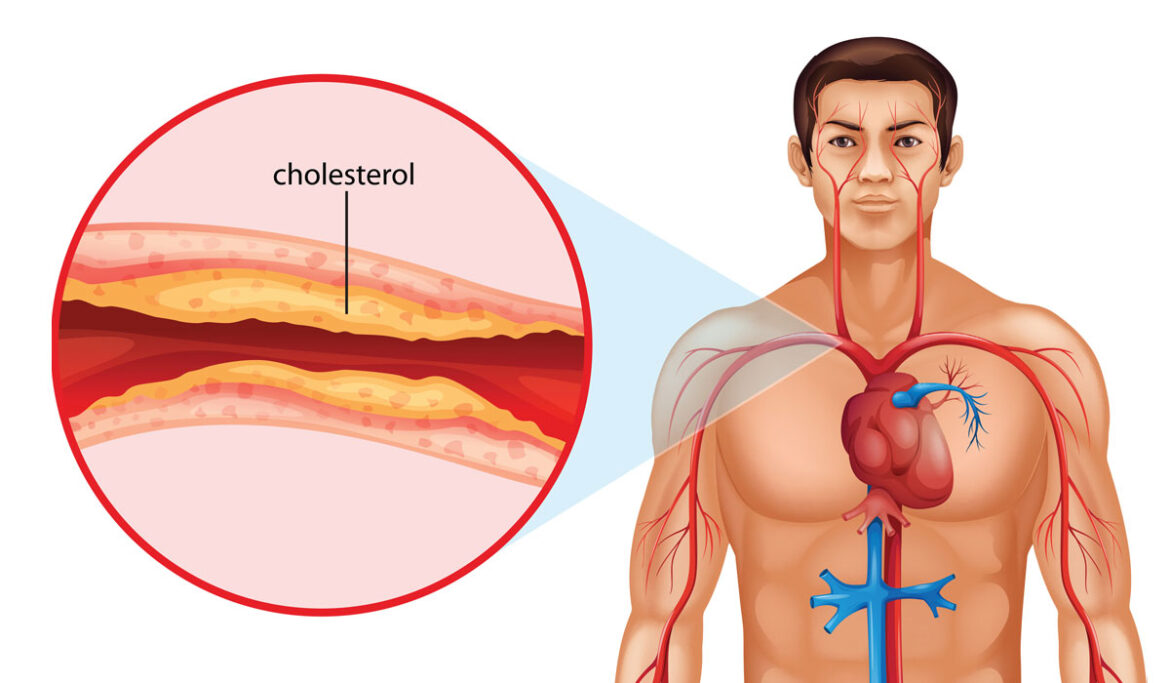 cholesterol-fact-or-fiction