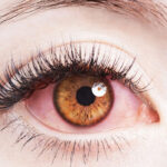 Conjunctivitis (Pink Eye): Cause, Symptoms and Treatments