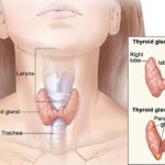 Thyroid Causes and Symptoms including its Treatment