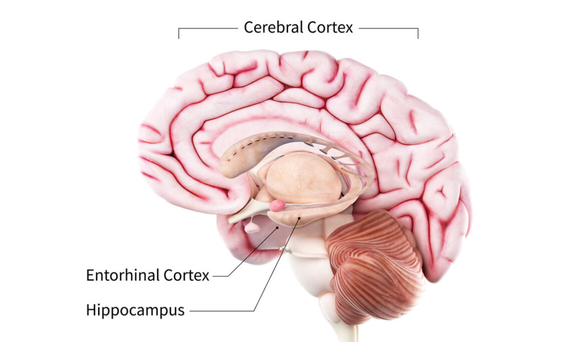alzheimer-disease-1