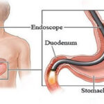 Venkateshwar Platinum Health Checkup With (Endoscopy)
