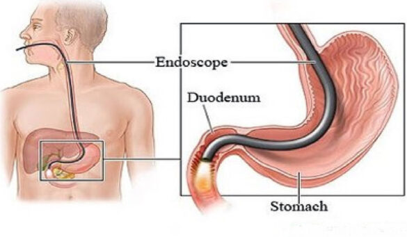 latinum Health Checkup With (Endoscopy)