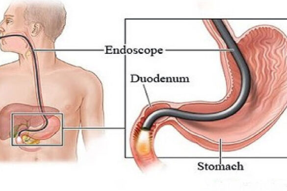 latinum Health Checkup With (Endoscopy)
