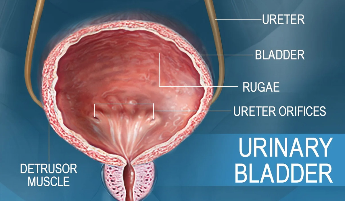 Bladder Cancer Treatment in India BCG Bladder Cancer Surgery