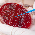 What is Biopsy?