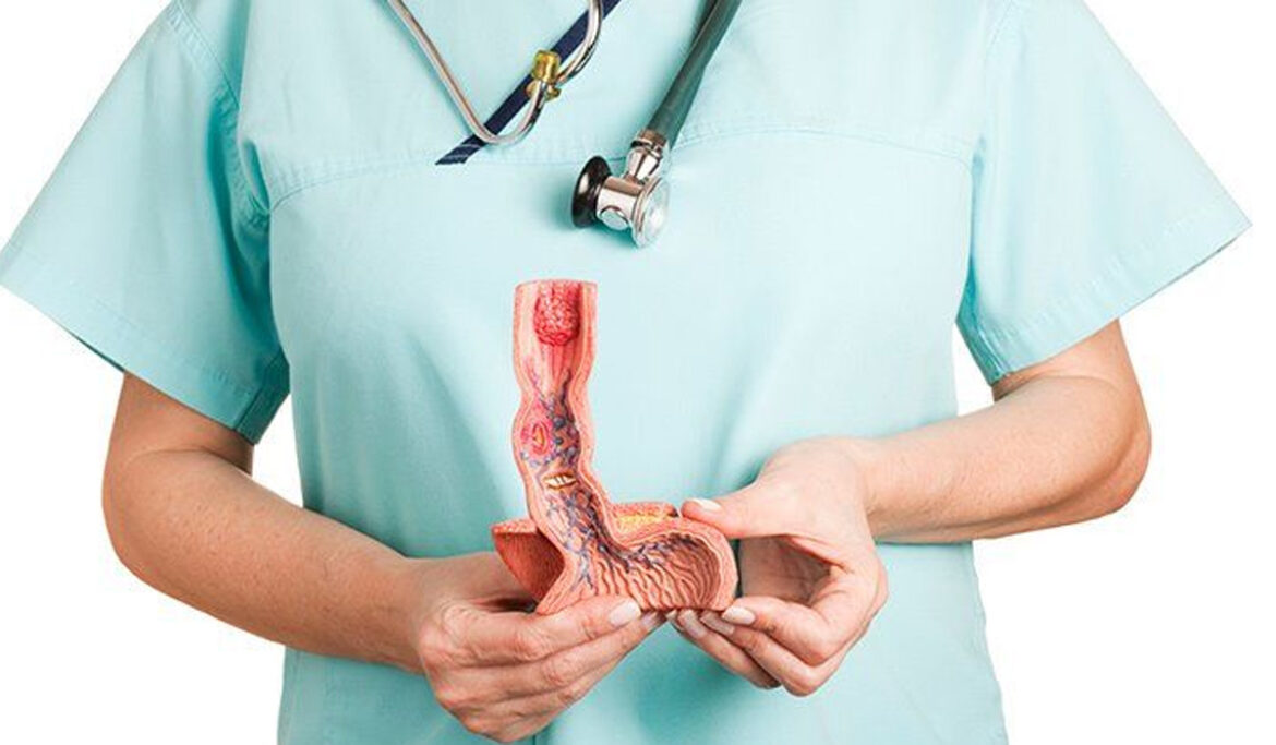 banner-esophageal