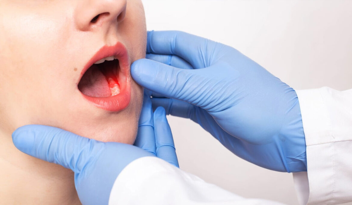 banner-oral-cencer