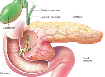 gallbladder-surgery-in-india