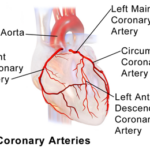 Coronary Angiography in India