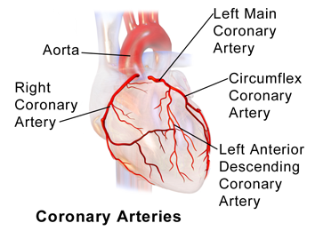 icon_20_350 coronary-angiography
