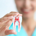 Root Canal Treatment in India