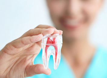 root-canal-treatment