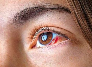 eye-cancer-treatment