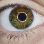 Retinal Detachment in India
