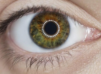 retinal-detachment-in-india