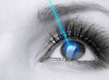 icon_297_7030 refractive-surgery