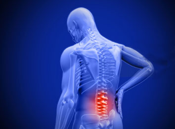 microdiscectomy-surgery-in-india