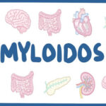 Amyloidosis Treatment in India