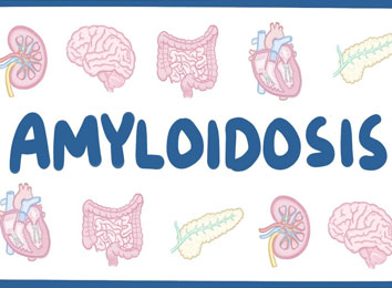 amyloidosis