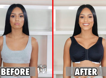 Breast-Augmentation-Surgery-in-India