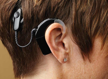 cochlear-implant-surgery-in-india