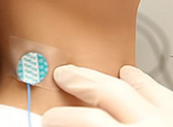 thyroplasty-in-india