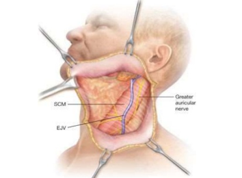 icon_72_8960 block-dissection-of-neck